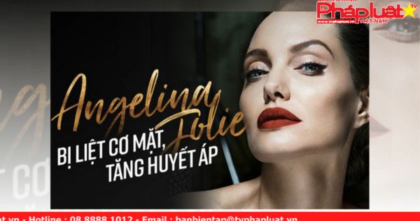 Angelina Jolie mắc chứng liệt cơ mặt