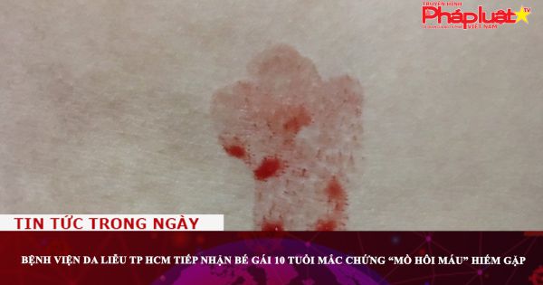 Bệnh viện Da Liễu TP HCM tiếp nhận bé gái 10 tuổi mắc chứng “mồ hôi máu” hiếm gặp