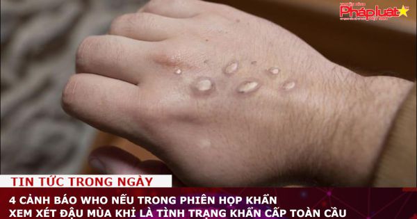 4 cảnh báo WHO nếu trong phiên họp khẩn xem xét đậu mùa khỉ là tình trạng khẩn cấp toàn cầu