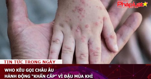 WHO kêu gọi Châu Âu hành động “khẩn cấp” vì đậu mùa khỉ