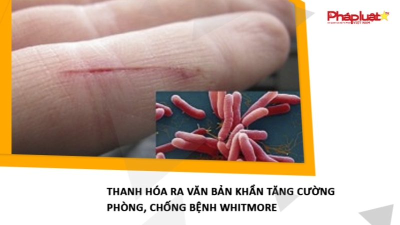 Thanh Hóa ra văn bản khẩn tăng cường phòng, chống bệnh Whitmore